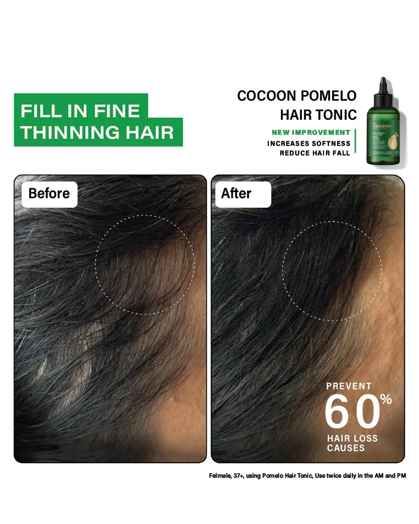 Bộ kích thích mọc tóc – Cocoon Hair Growth Set – 100% Vegan