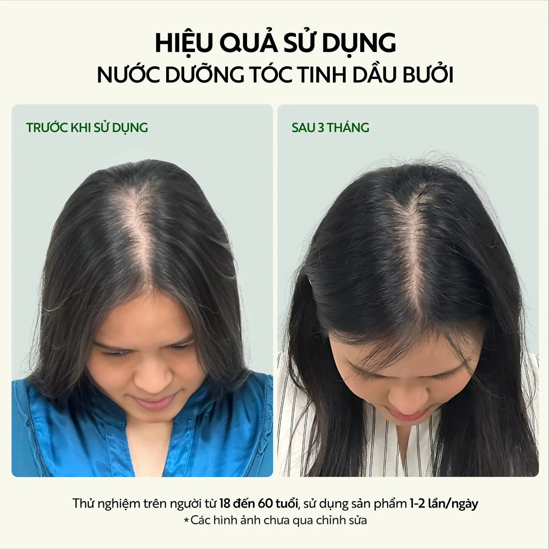 Bộ kích thích mọc tóc – Cocoon Hair Growth Set – 100% Vegan